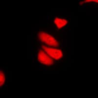 Polyclonal Rabbit anti-Human IFIH1 / MDA5 Antibody (C-Terminus, IHC, IF, WB)