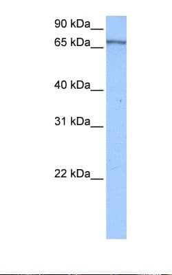 Polyclonal Rabbit anti-Human PABPC4 Antibody (aa432-481, WB)