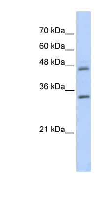 Polyclonal Rabbit anti-Human PRELP / Prolargin Antibody (aa251-300, IHC, WB)