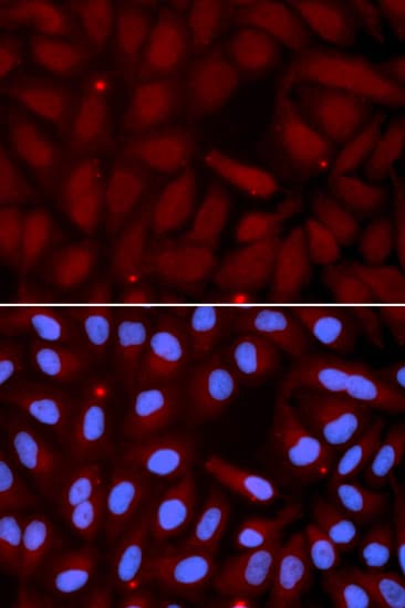 SFTPC / Surfactant Protein C Antibody
