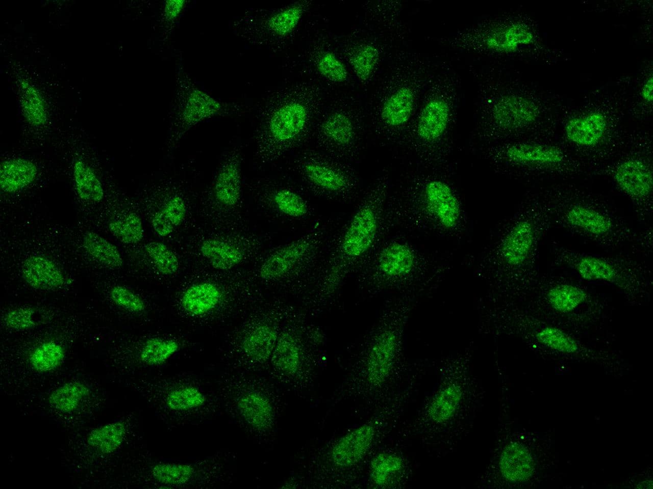 CTG-B45d / THAP11 Antibody