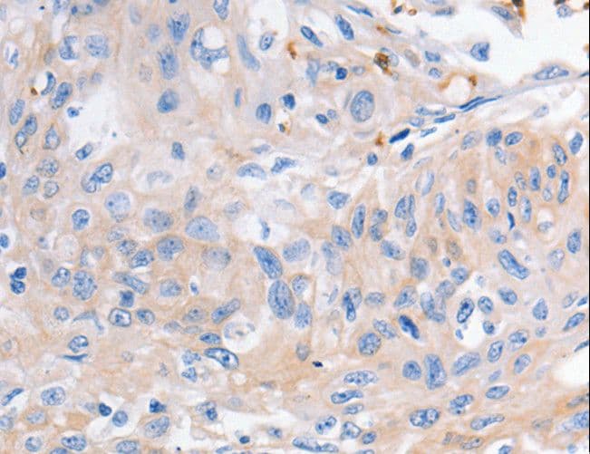 Polyclonal Rabbit anti-Human KCNA1 / Kv1.1 Antibody (IHC, WB)