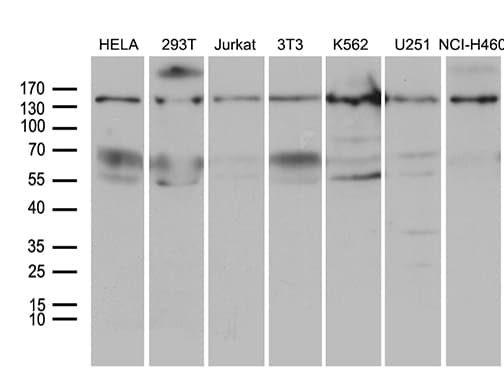 Monoclonal Mouse anti-Human SMC1A / SMC1 Antibody (clone OTI6C5, aa889-1016, WB)