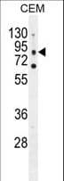 CLC-7 / CLCN7 Antibody (aa692-720)