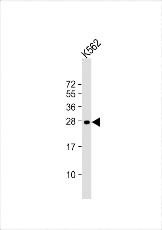 RAB27A / RAB27 Antibody (clone 1590CT813.266.26)