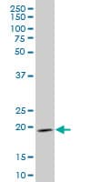 Monoclonal Mouse anti-Human IHH Antibody (clone 2G9, WB)