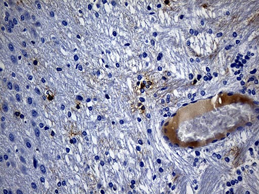 Monoclonal Mouse anti-Human GPR17 Antibody (clone OTI6B9, N-Terminus, IHC)