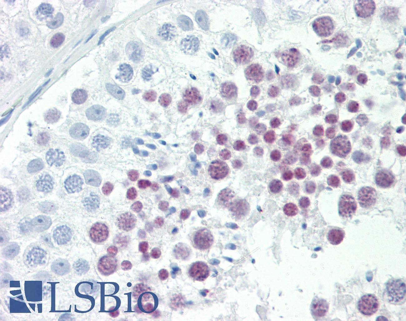 IHC-plus™ ID4 Antibody (aa1-50)