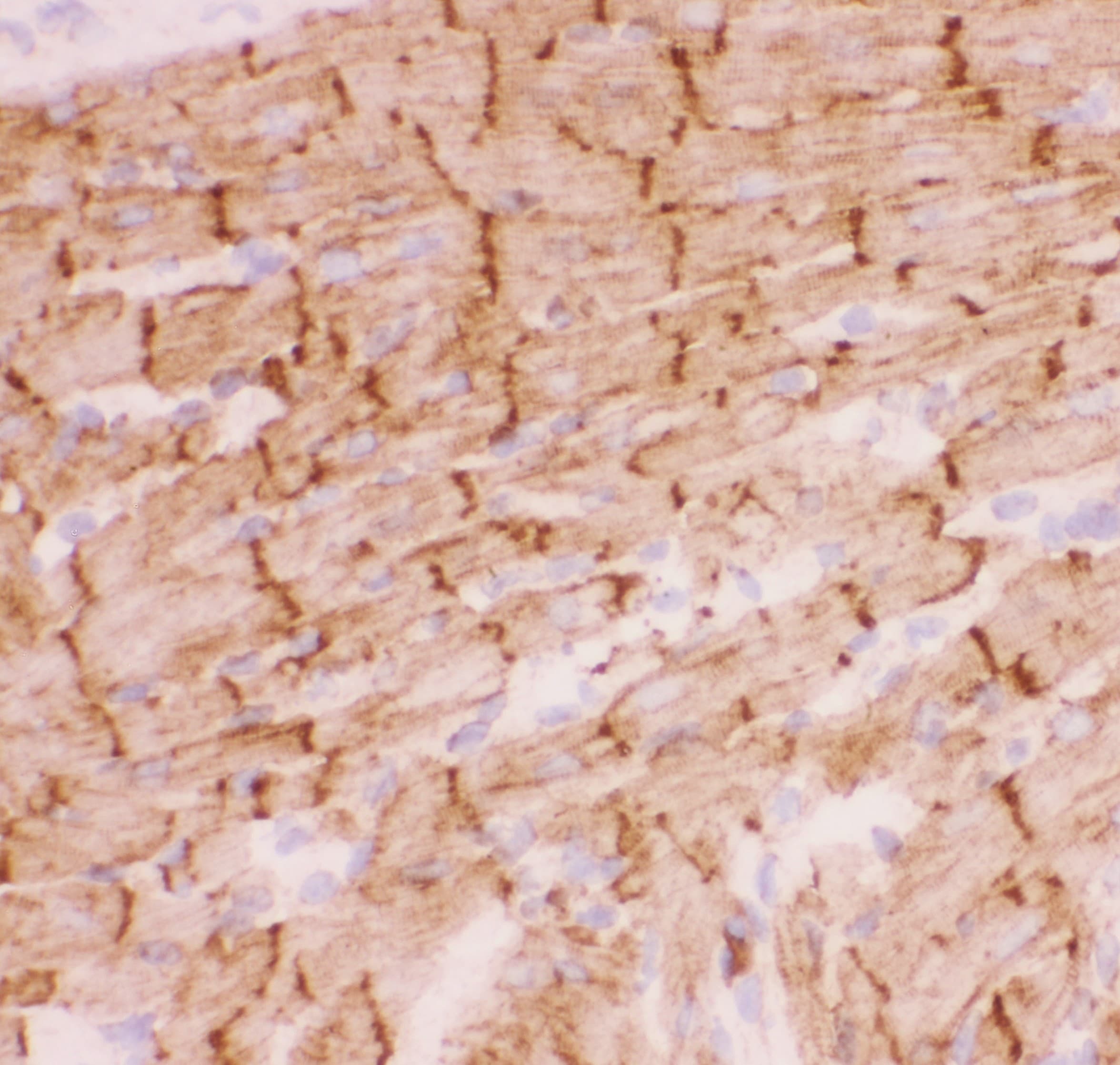 Polyclonal Rabbit anti-Human DES / Desmin Antibody (aa1-304, IHC, WB)