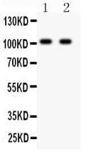 GRIA4 / GLUR4 Antibody (aa176-350)