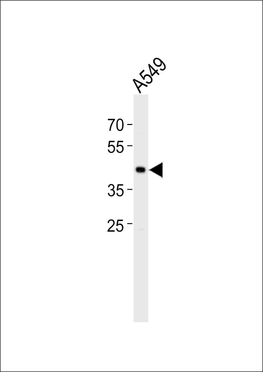 Polyclonal Rabbit anti-Human TGIF1 Antibody (aa81-109, WB)