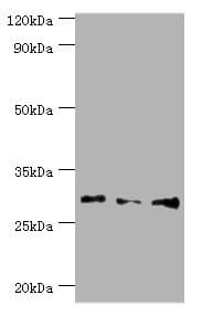 Polyclonal Rabbit anti-Human HOXB5 Antibody (aa1-170, IHC, WB)