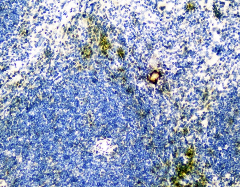 VCAM1 / CD106 Antibody
