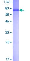 Human PHGDH Protein (Recombinant GST)
