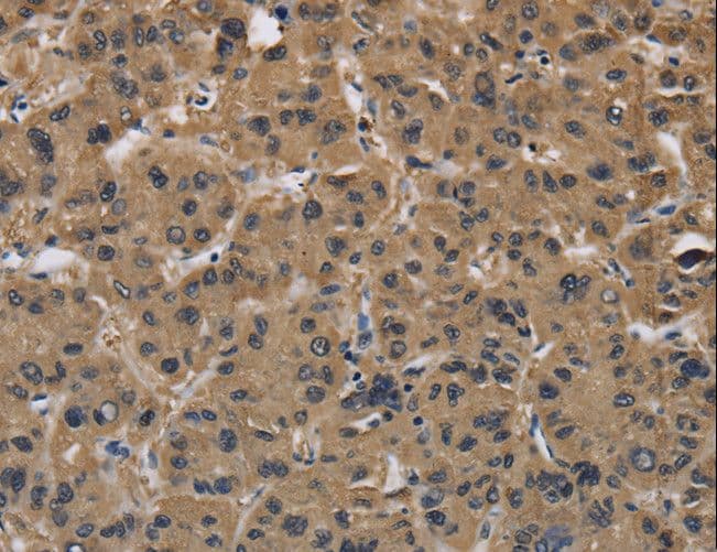I-FABP / FABP2 Antibody