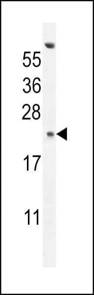 Polyclonal Rabbit anti-Human GAGE13 Antibody (aa1-30, IHC, WB)
