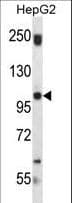 Polyclonal Rabbit anti-Human SND1 Antibody (aa449-478, WB)