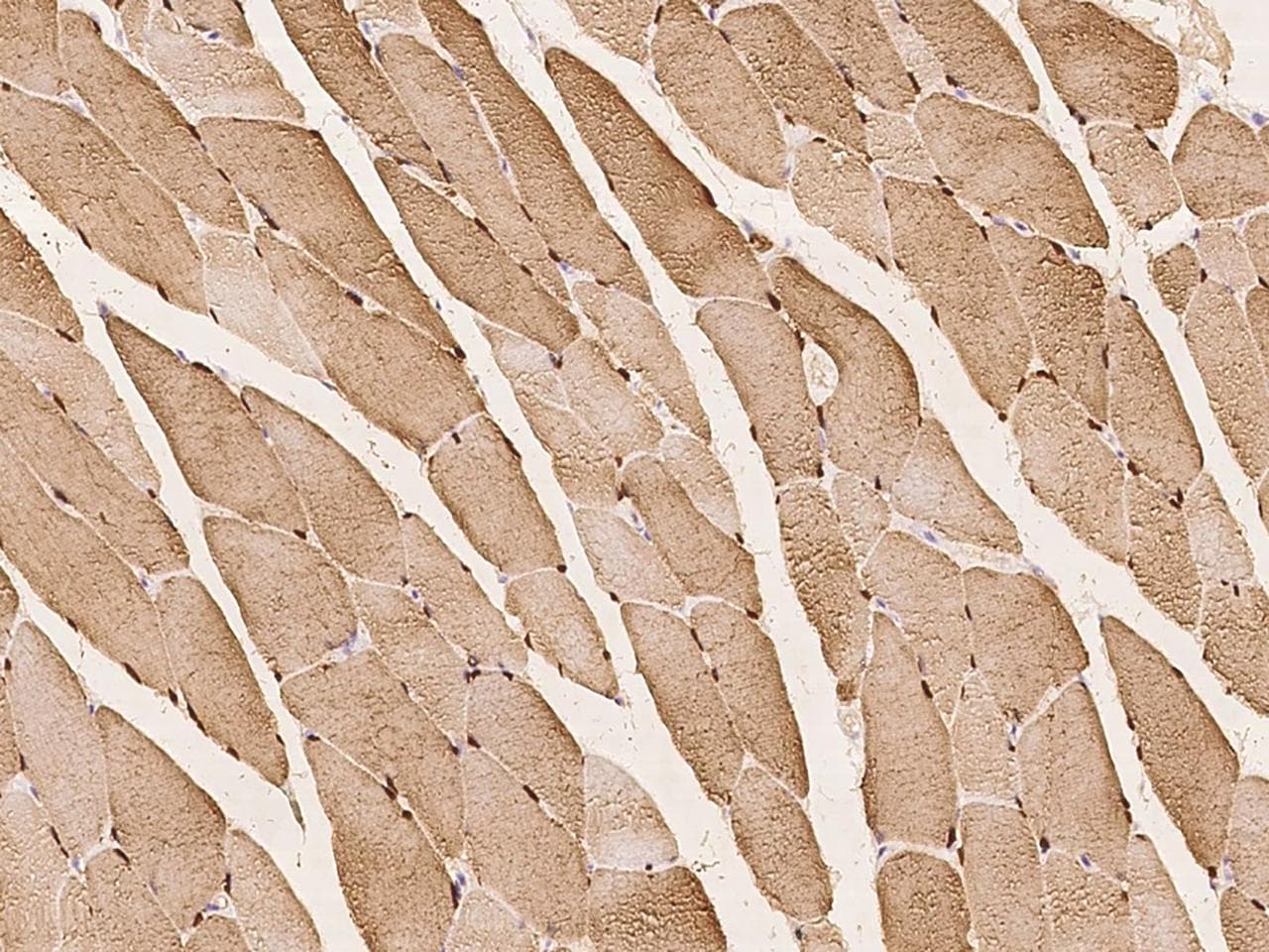 Polyclonal Rabbit anti-Human MB / Myoglobin Antibody (IHC)