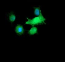 Monoclonal Mouse anti-Human RAB30 Antibody (clone OTI3F4, IF, WB)
