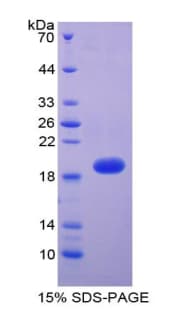 Human THBD / CD141 / Thrombomodulin Protein (Recombinant His-T7)