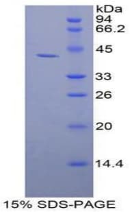 Human GSN / Gelsolin Protein (Recombinant His-GST)