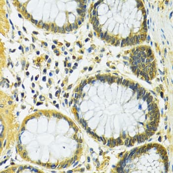 Polyclonal Rabbit anti-Human SLC25A1 / SEA Antibody (IHC, WB)