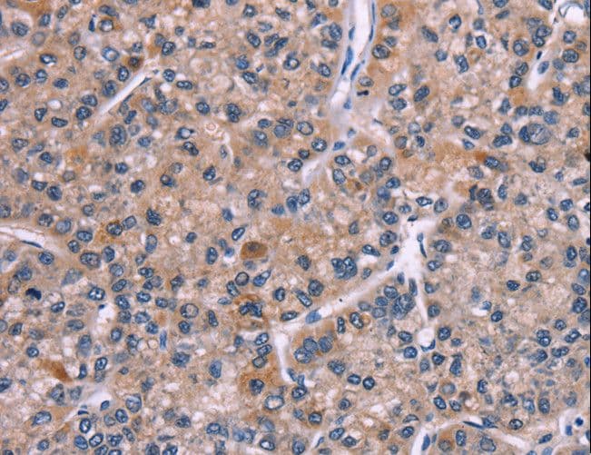PIP5K1B Antibody