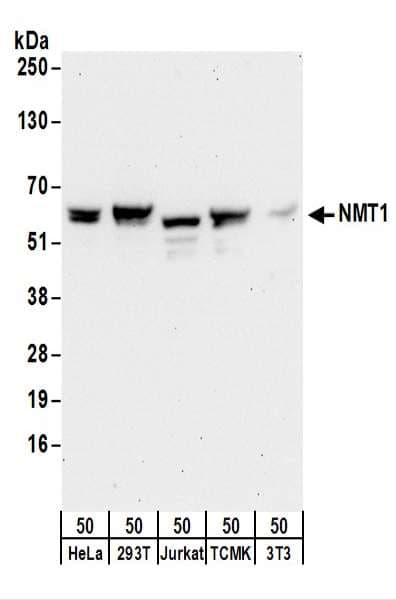 IHC-plus™ Polyclonal Rabbit anti-Human NMT1 Antibody (aa68-118, IHC, WB)