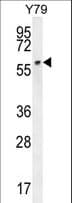 Polyclonal Rabbit anti-Human MLR2 / LCOR Antibody (aa322-350, WB)