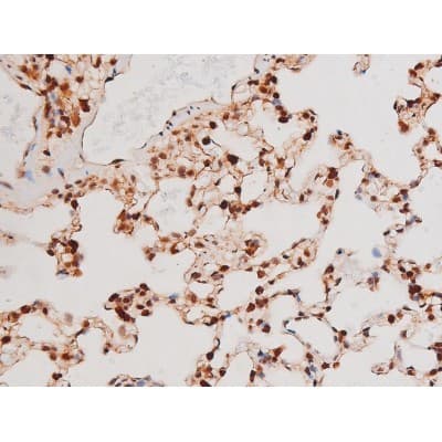 STAT3 Antibody (phospho-Tyr705)