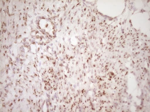 LPIN1 / Lipin 1 Antibody (clone OTI8F10)