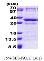 Human CNOT8 Protein (Recombinant His)