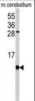 Polyclonal Rabbit anti-Human FKBP1B / FKBP12.6 Antibody (aa16-46, IHC, IF, WB)