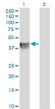 BGN / Biglycan Antibody (clone 4E1-1G7)