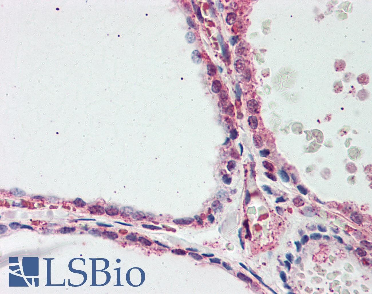 Polyclonal Rabbit anti-Human ACO1 / Aconitase Antibody (N-Terminus, IHC, WB)
