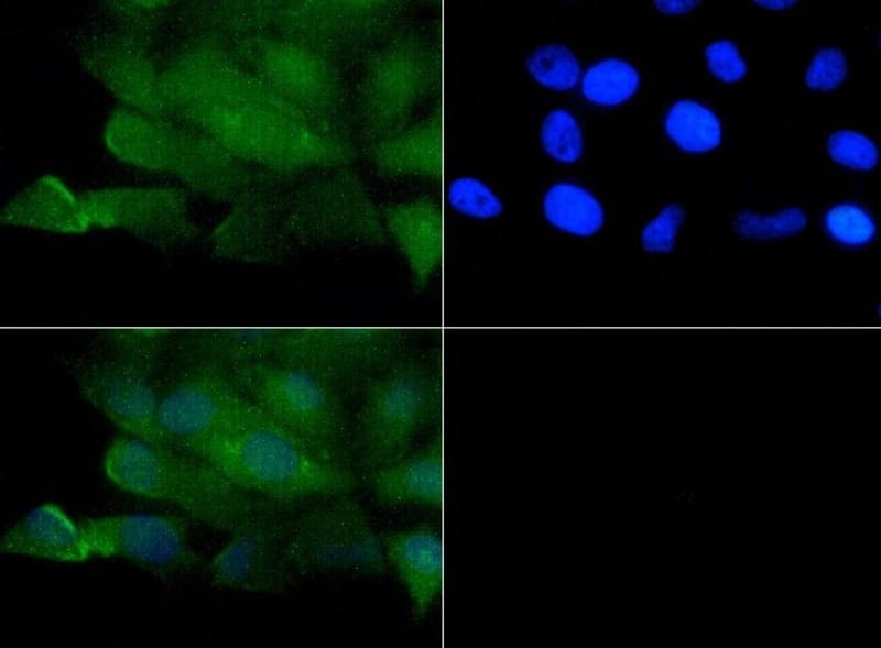 PathPlus™ VR1 / TRPV1 Antibody