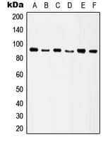Polyclonal Rabbit anti-Human ITGB5 / Integrin Beta 5 Antibody (C-Terminus, WB)