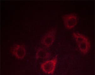 CXCR2 Antibody (phospho-Ser347)