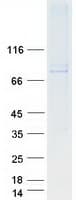 Human SOLO / SESTD1 Protein (Recombinant Myc-DDK (Flag))