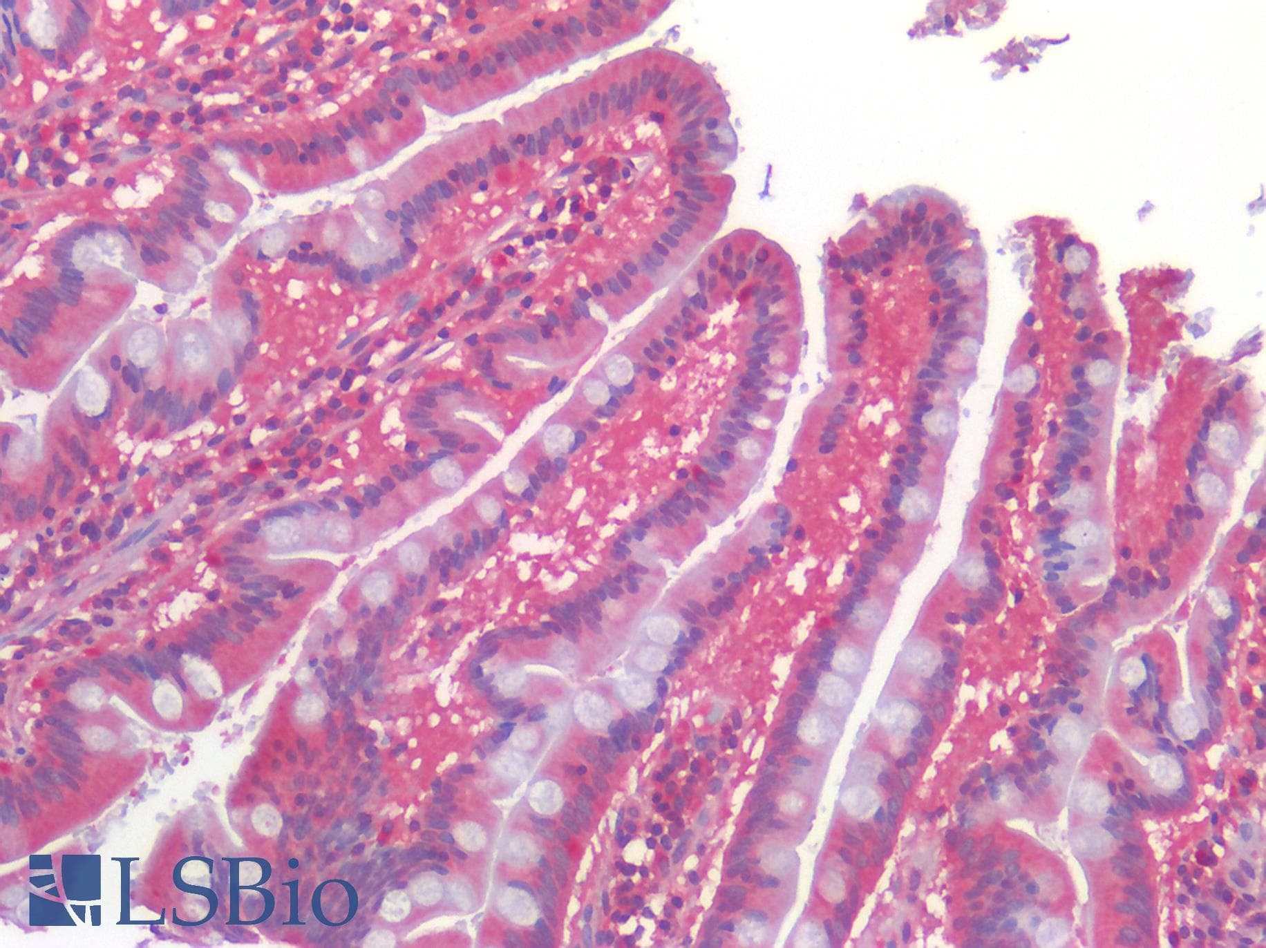 PathPlus™ GPR160 Antibody (Extracellular Domain)
