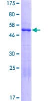 Human CDV3 Protein (Recombinant GST)