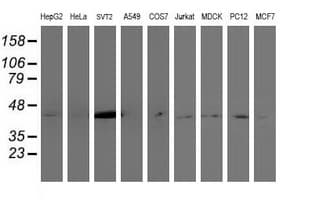 NUDEL / NDEL1 Antibody (clone OTI1G10)