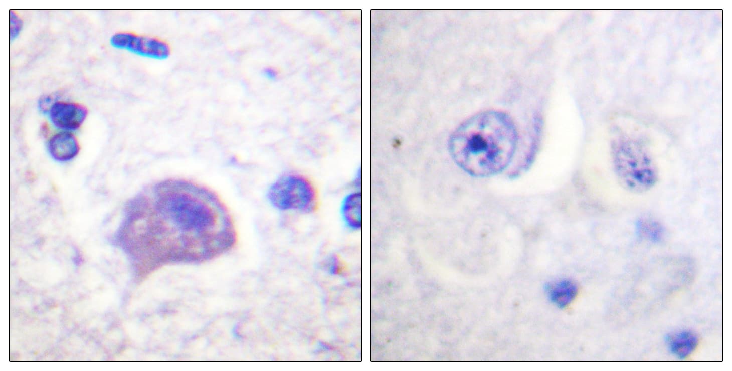 HRS / HGS Antibody (aa301-350)