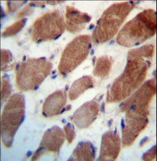 Polyclonal Rabbit anti-Human TRIM54 / MURF Antibody (aa1-30, IHC, WB)