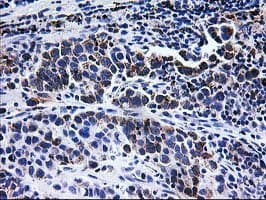 CCM2 / Malcavernin Antibody (clone OTI1E9)