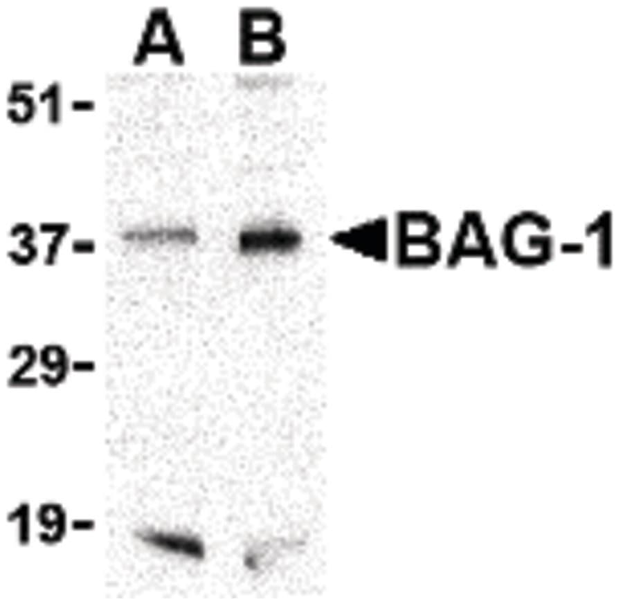 IHC-plus™ Polyclonal Rabbit anti-Human BAG1 / BAG-1 Antibody (IHC, IF, WB)