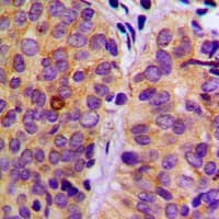 PLCG2 / PLC Gamma 2 Antibody (phospho-Tyr753)