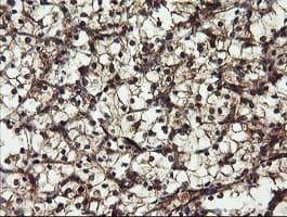 DOK7 Antibody (clone OTI1F7)