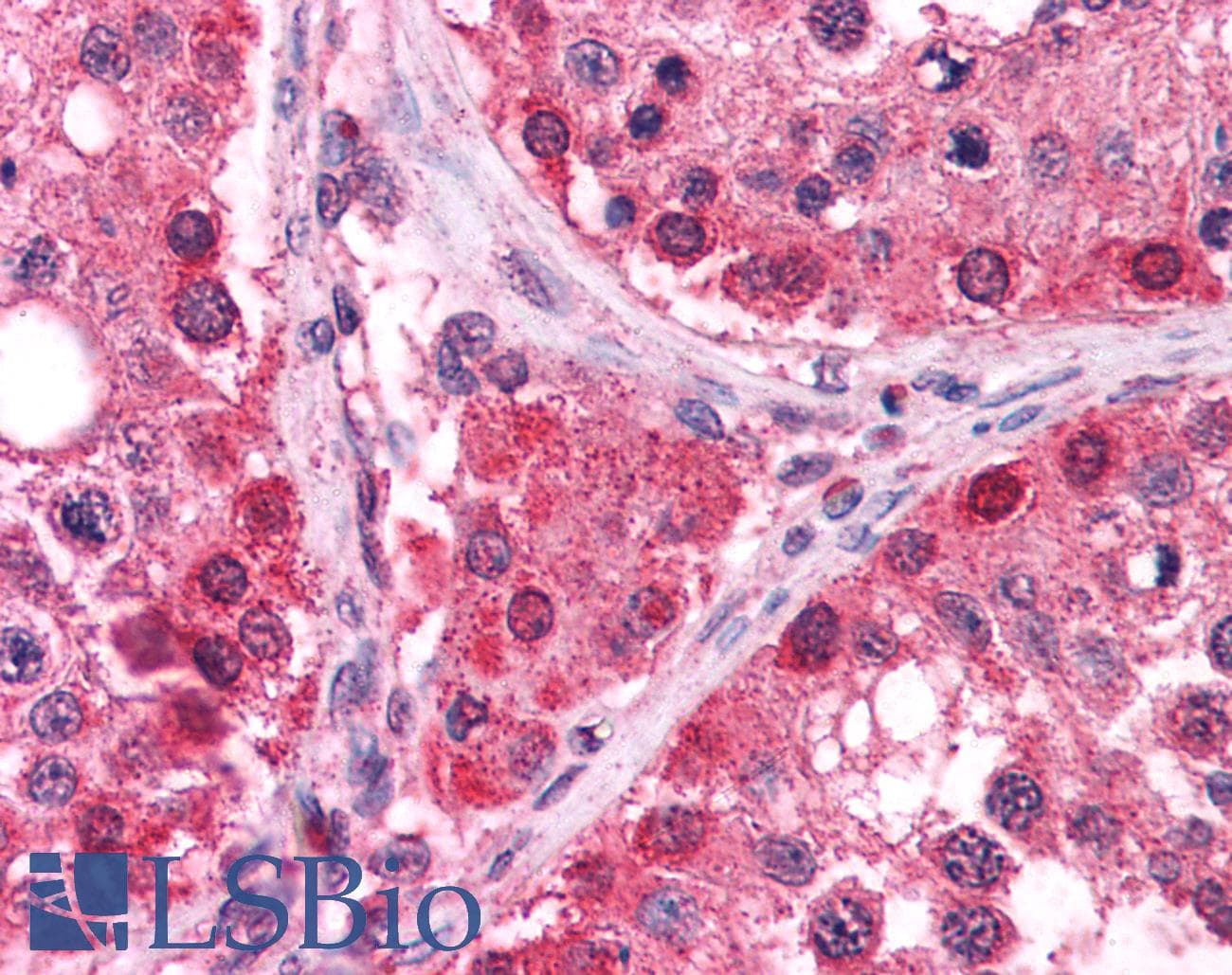 IHC-plus™ TRXR1 / TXNRD1 Antibody (aa600-612)