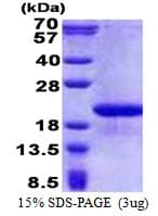Human FAM107B Protein (Recombinant His)